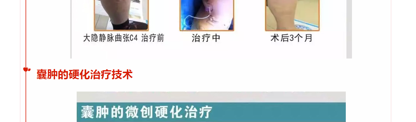 医讯：永济市人民医院外科特聘秦增辉教授定期来院坐诊